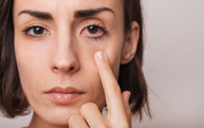 How Do You Know If You Have Dry Eye or Allergies?